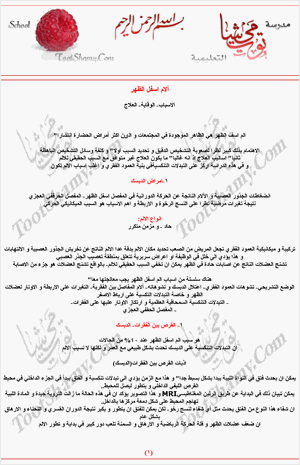 آلآم أسفل الظهر
