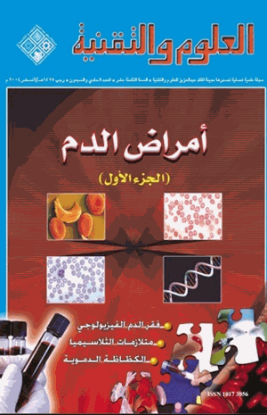 أمراض الدم
